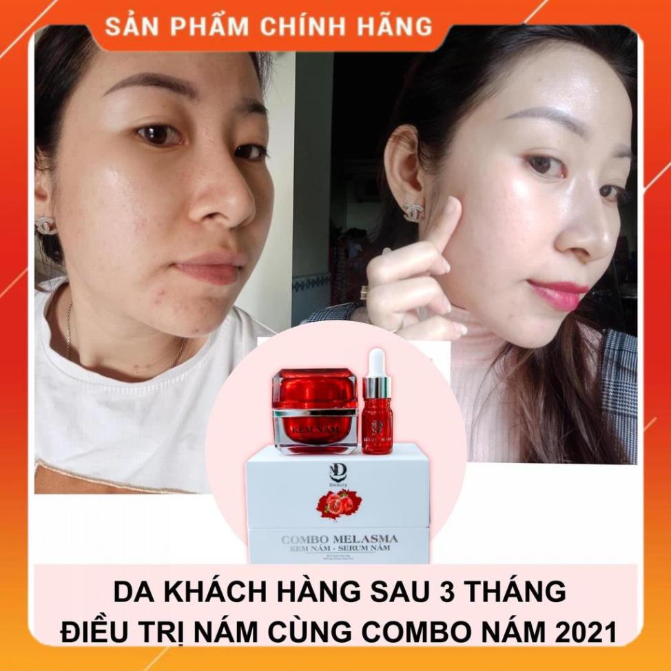 Kem Face Nám Lựu Đỏ MD Beauty Dưỡng Trắng Da, Loại Bỏ Mụn Nám Tàn Nhang