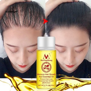 Tinh dầu chăm sóc tóc kích mọc tóc hiệu quả