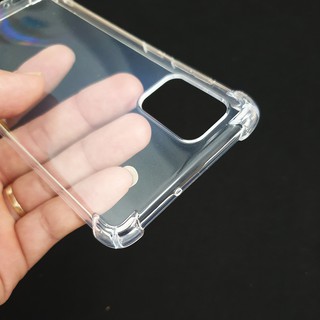 Ốp lưng dẻo chống sốc Samsung Galaxy A71