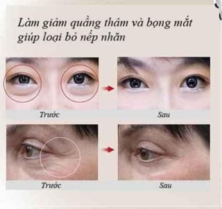 Bút trị mụn trứng cá Medisana