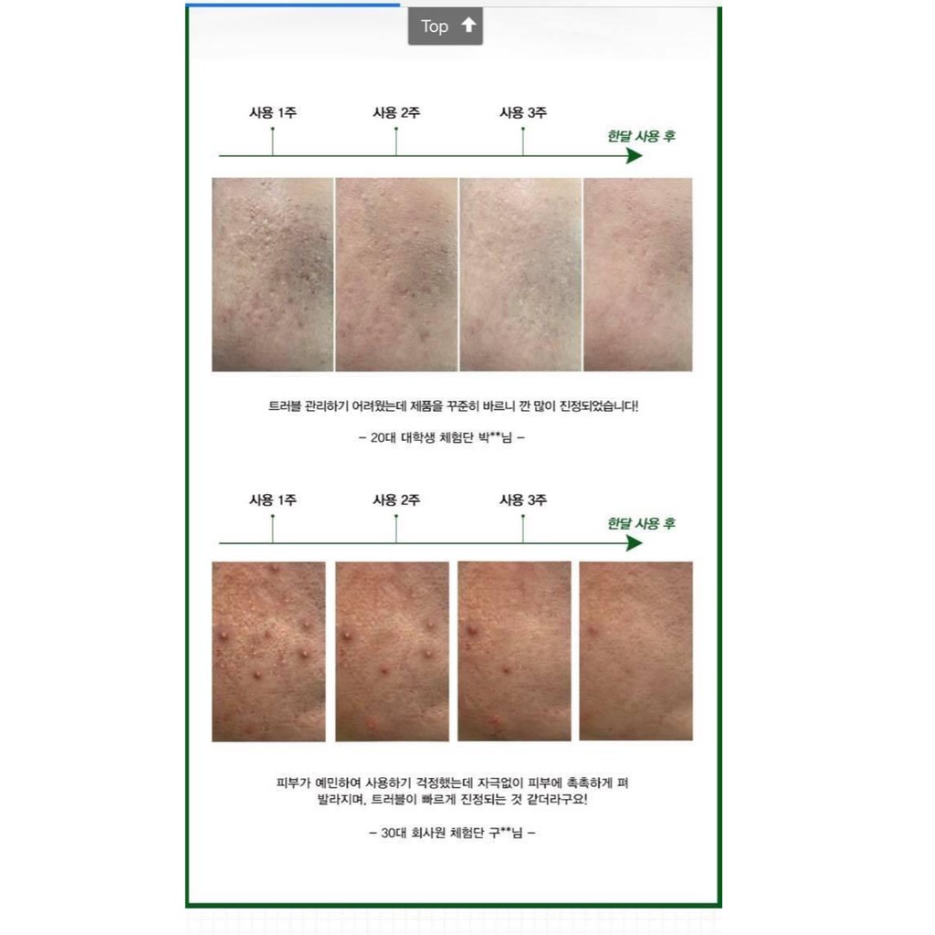 KEM CHẤM MỤN AC | BigBuy360 - bigbuy360.vn