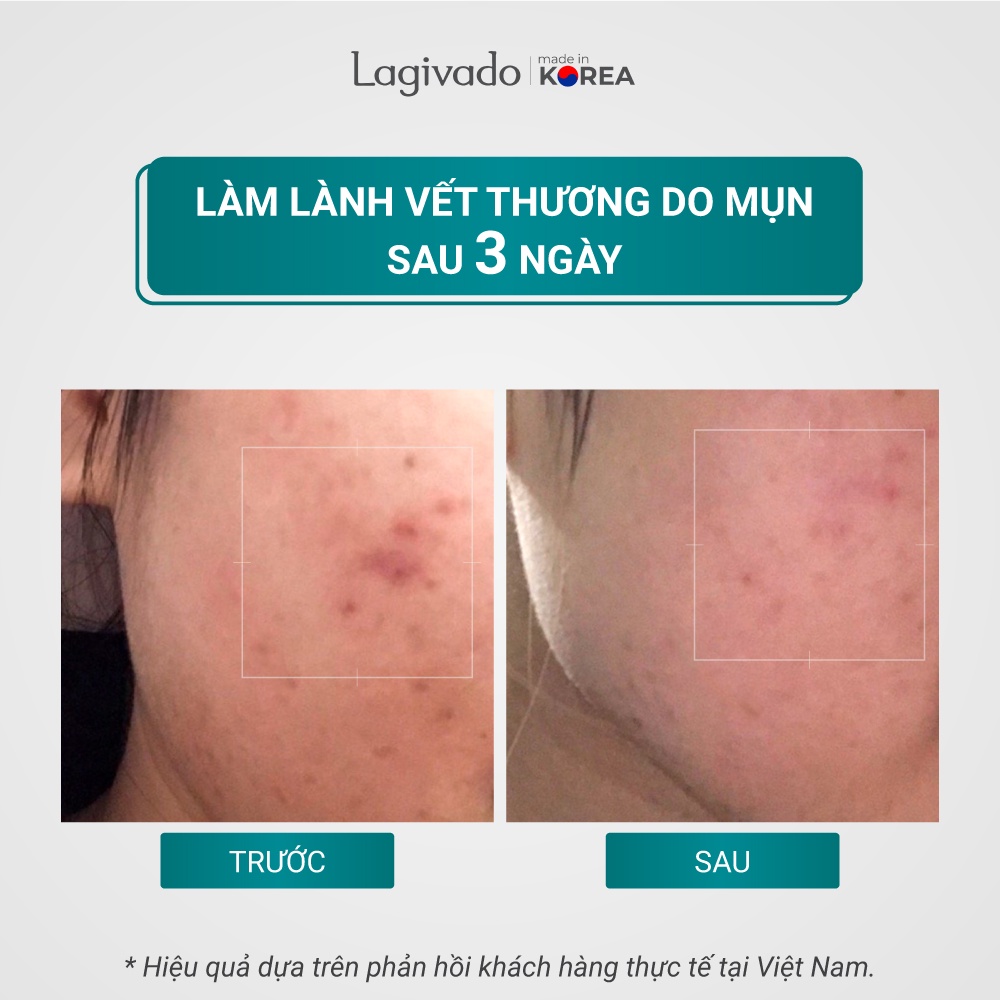 [Hàng chính hãng] - Kem giảm mụn, ngăn ngừa thâm sẹo Hàn Quốc Lagivado Dr. Atreat Cream 30 ml