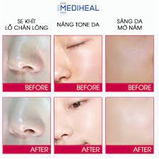 Kem Mặt Mediheal Bright Melakill Cream 35ml Dạng Tuýp