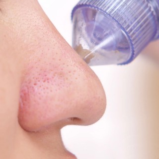 Máy hút mụn Derma Suction