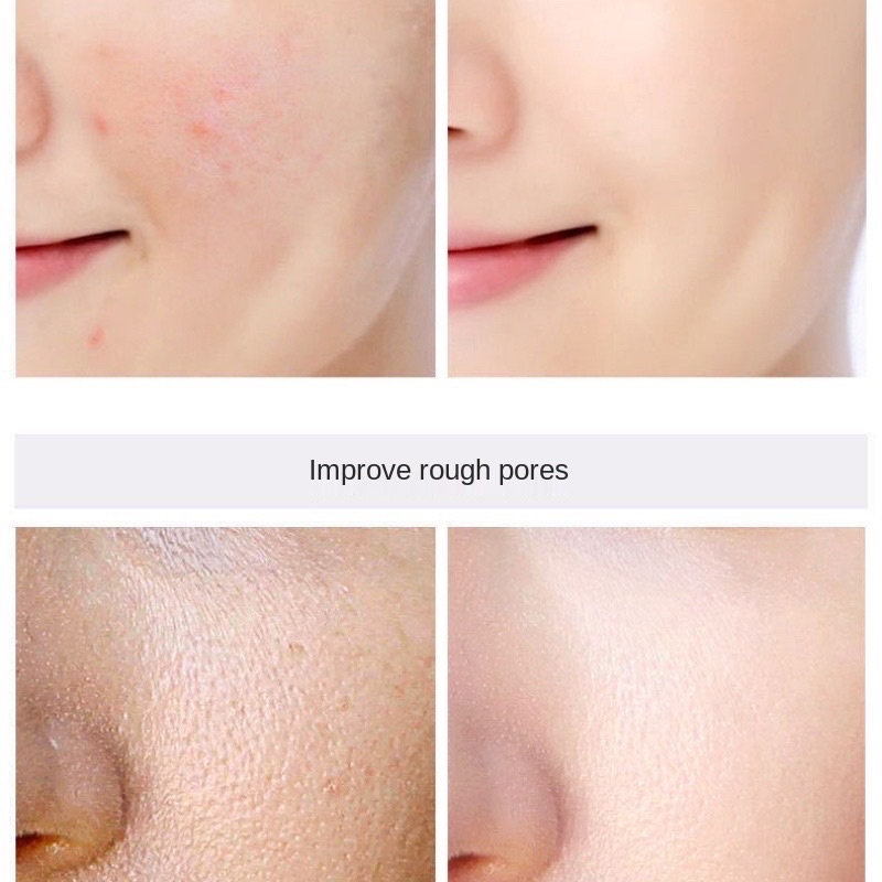 Viên serum dưỡng da tinh chất cá hồi ngoc trai trắng mịn căng bóng ngừa mụn xoá thâm