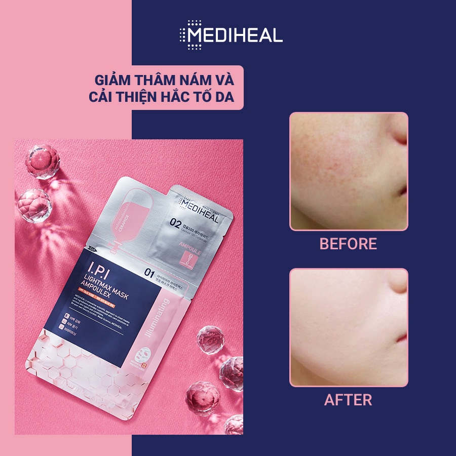 Mặt Nạ Mediheal Siêu Dưỡng Trắng Phiên Bản 2 Bước I.P.I Lightmax Mask Ampoulex 30ML [K66]