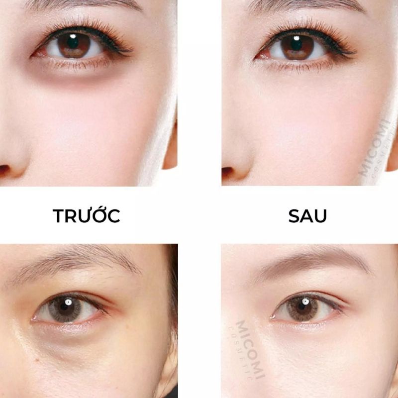 Mặt nạ mắt images cung cấp ẩm giảm nếp nhăn bọng mắt dưỡng ẩm mờ thâm DAKAVA MNM01 | BigBuy360 - bigbuy360.vn