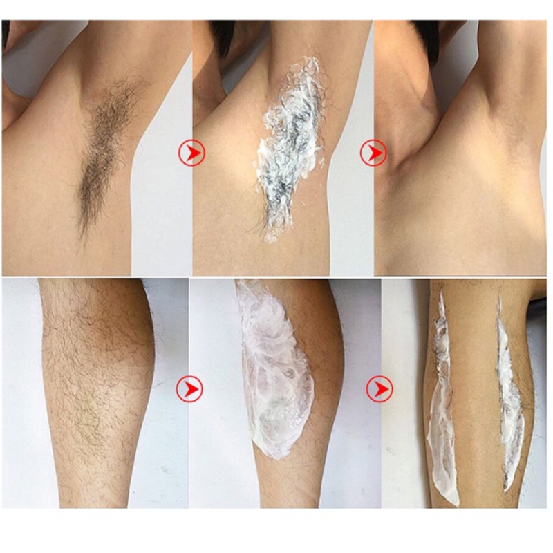 Tẩy lông không đau kem tẩy lông vĩnh viễn ức chế sự phát triển lông thân