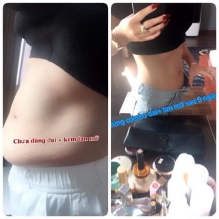 KEM TAN MỠ DR.LACIR VÀ GEL NỊT BỤNG DR.SLIM