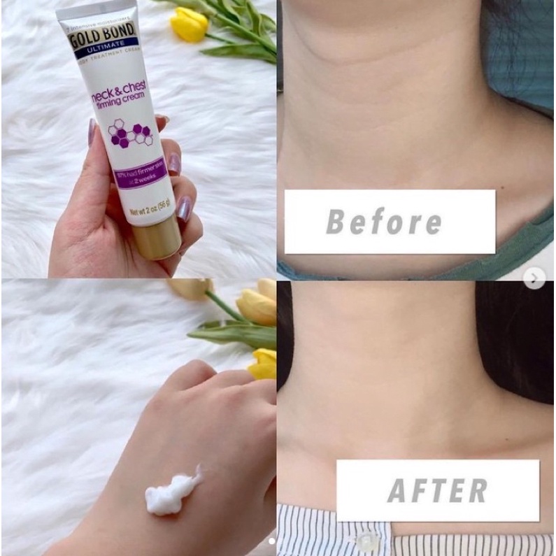 Gold Bond - Kem dưỡng cổ và ngực Gold Bond Ultimate Neck & Chest Firming Cream 56G