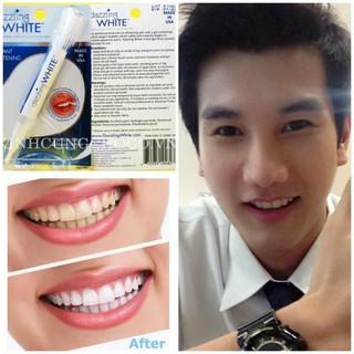 Bút Tẩy Trắng Răng DAZZLING WHITE