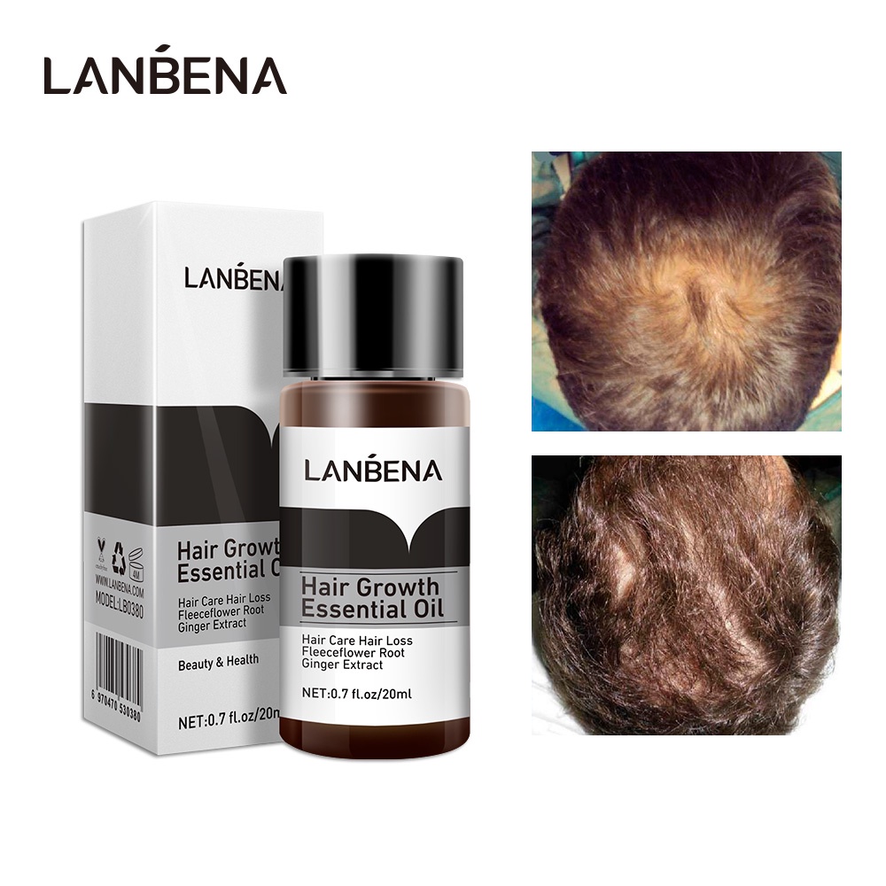 Tinh Chất Kích Mọc Tóc Lanebna Hỗ Trợ Kích Thích Tinh Dầu Mọc Tóc Hiệu Quả Ngăn Rụng Tóc 20ml
