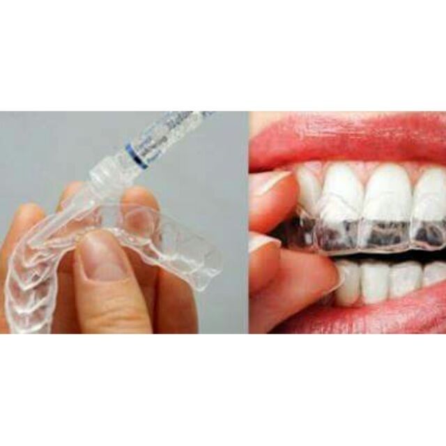 Máng tẩy trắng tại nhà khít răng 100%