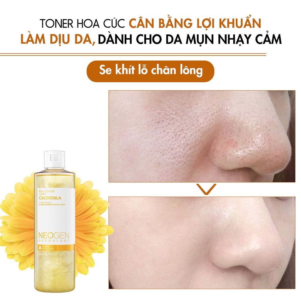 Toner Hoa Cúc Cân Bằng Lợi Khuẩn, Làm Dịu Da, Siêu Cấp Ẩm Cho Da Mụn Nhạy Cảm Neogen Dermalogy 300ml