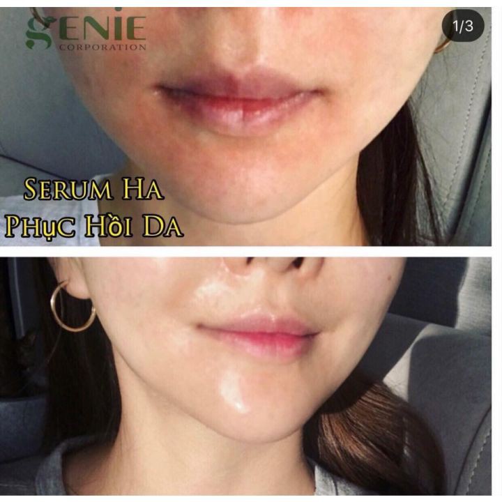 Serum HA cấp ẩm căng bóng da Genie 100ML