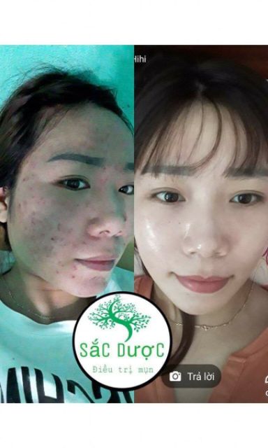 Đông y sắc dược