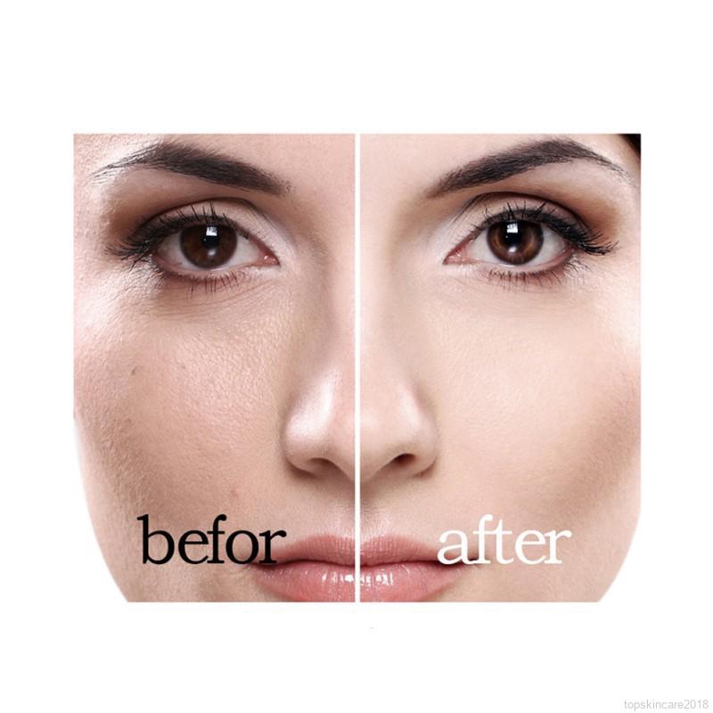 [Hàng mới về] Kem BB cream Hengfang che khuyết điểm và làm trắng da 35ml | BigBuy360 - bigbuy360.vn