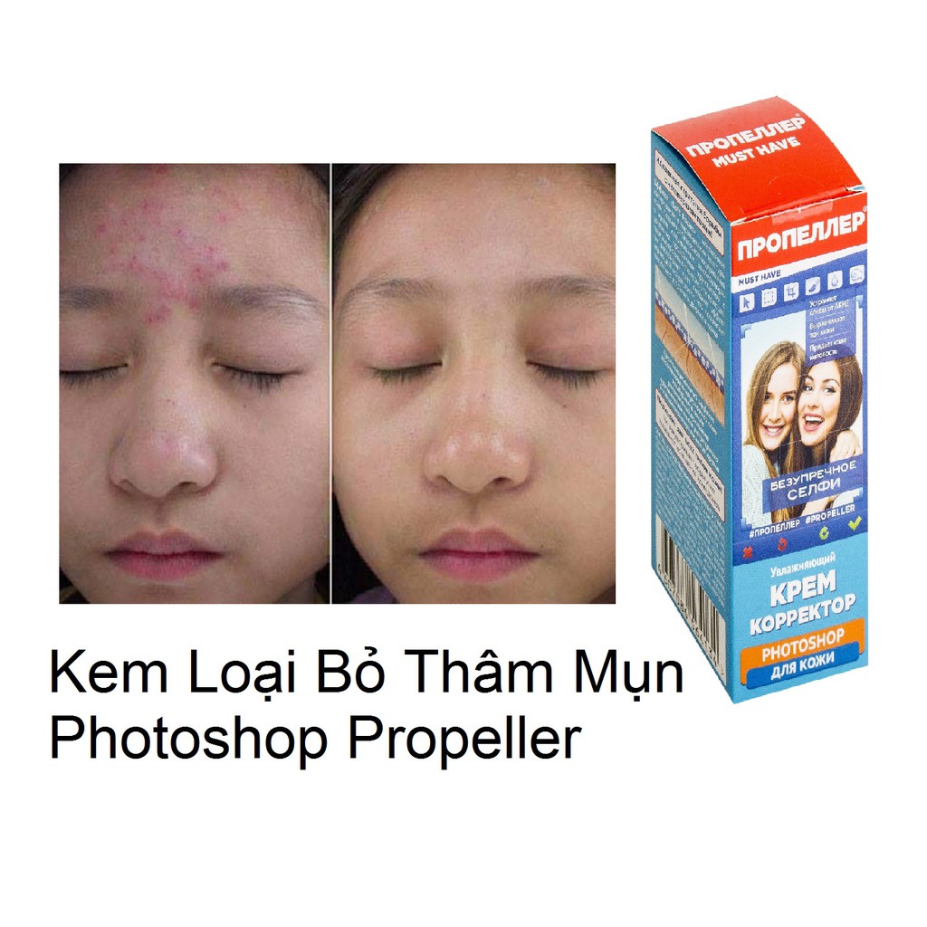 KEM LOẠI BỎ THÂM SAU MỤN PHOTOSHOP PROPELLER NGA