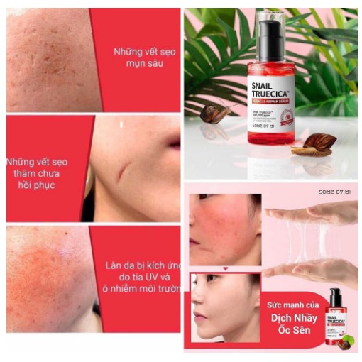 Combo Giúp Da Săn Chắc, Cải Thiện Thâm Sẹo Chiết Xuất Ốc Sên Some By Mi Snail Truecica Miracle Repair (Toner + Serum)