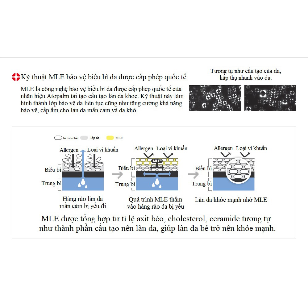 Kem dưỡng ẩm cho bé ATOPLAM MLE Cream 100ml (chính hãng Hàn Quốc)
