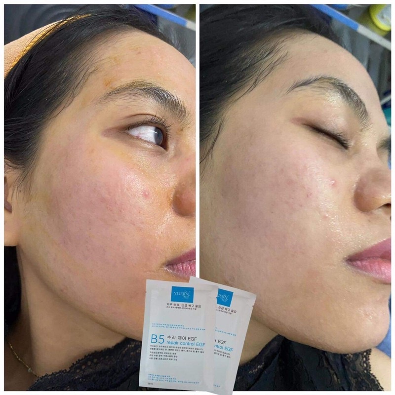 Mặt nạ b5 yuejin repair control dgf mask phục hồi cấp ẩm chính hãng 25ml hàn quốc
