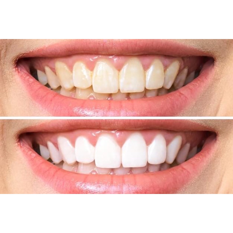 Bột & Kem Đánh Răng Làm Trắng EUCRYL Tooth Paste Freshmint