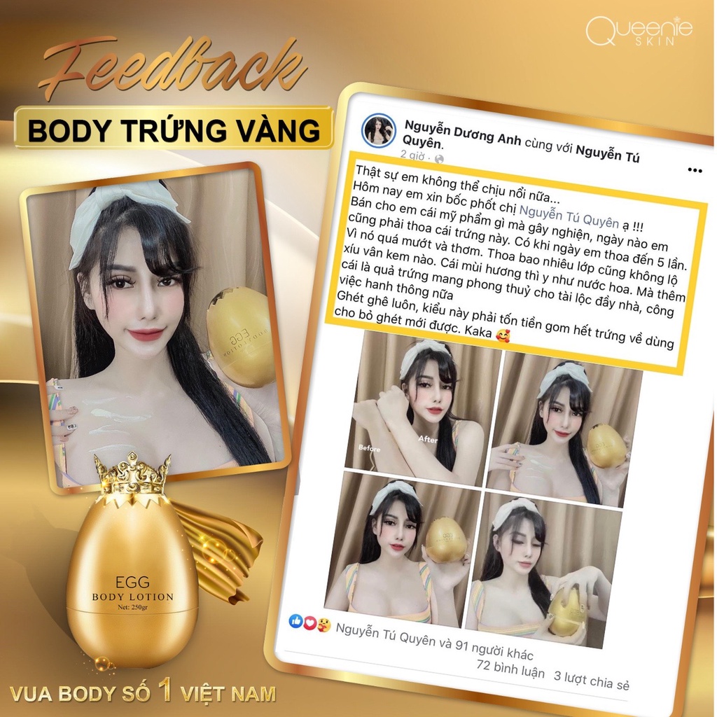 [Chính Hãng + Tặng Tắm Trắng Trứng] Kem Body Trứng Vàng Queenie Skin - Kem Body Trứng 2024 - Kem Trứng Vàng Queenie Skin