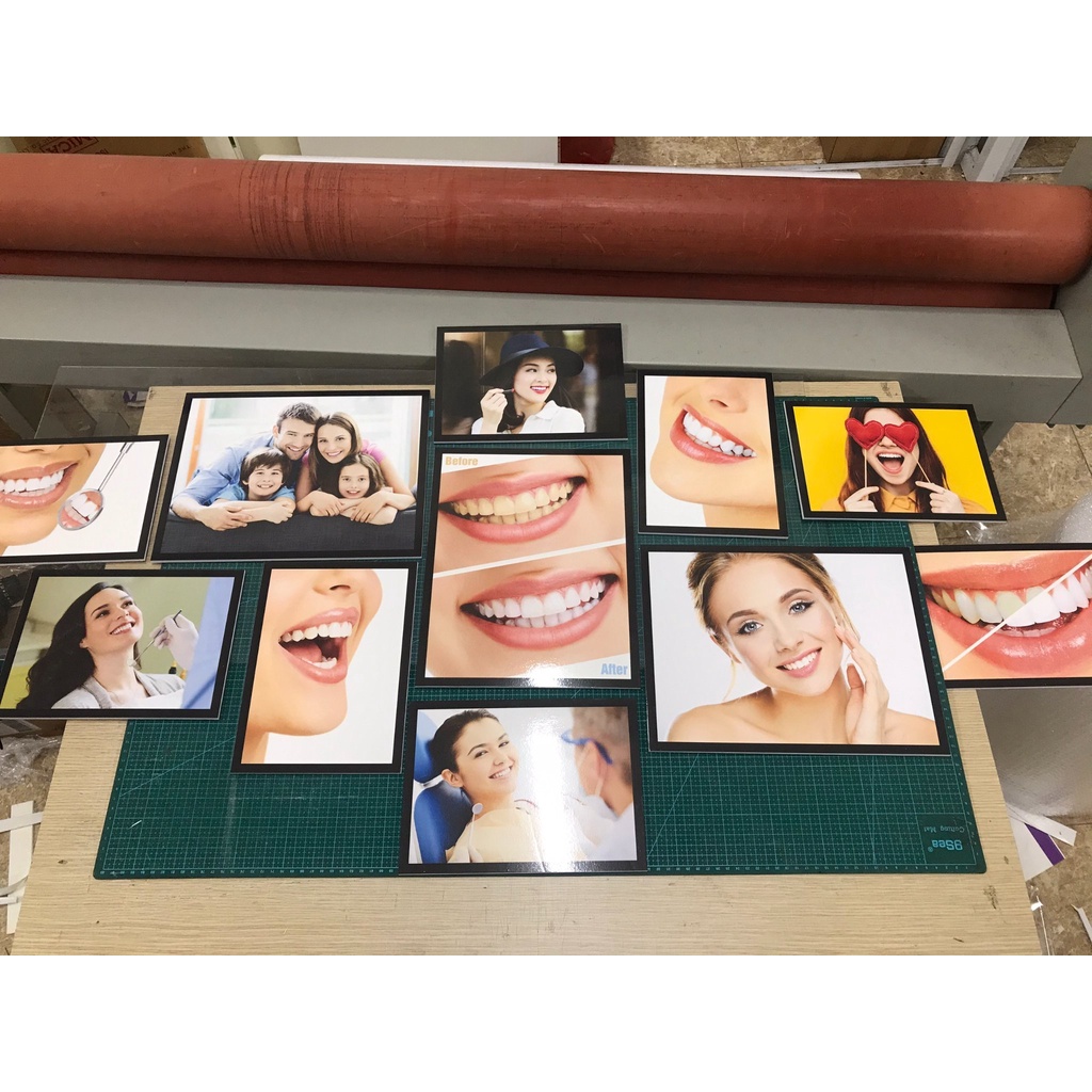 Set tranh fomex trang trí nha khoa