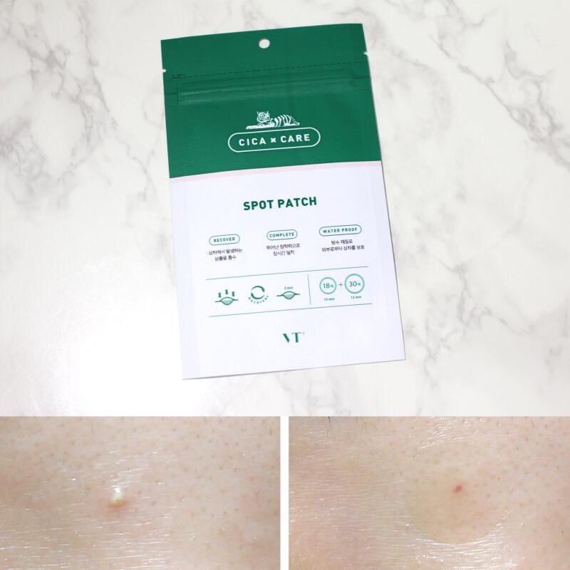 Miếng dán mụn VT Cosmetics Cica Spot Patch 48 miếng | WebRaoVat - webraovat.net.vn