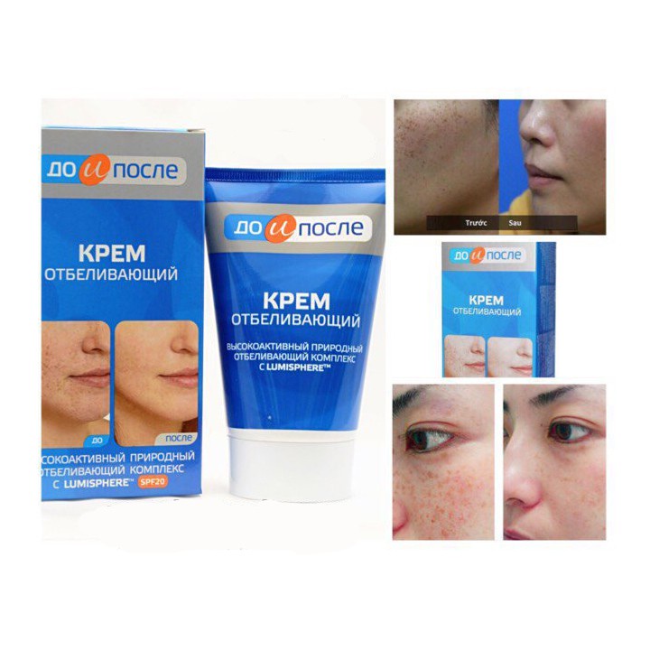 Kem dưỡng Kpem mờ nám Nga SPF20 Tuýp 100ml