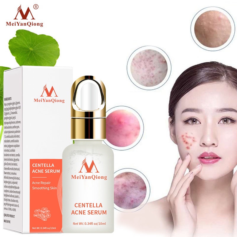 Serum hỗ trợ trị Mụn Trứng Tinh Chất Rau Má MeiYanQiong Kiềm Dầu Và Dưỡng Ẩm 10ml