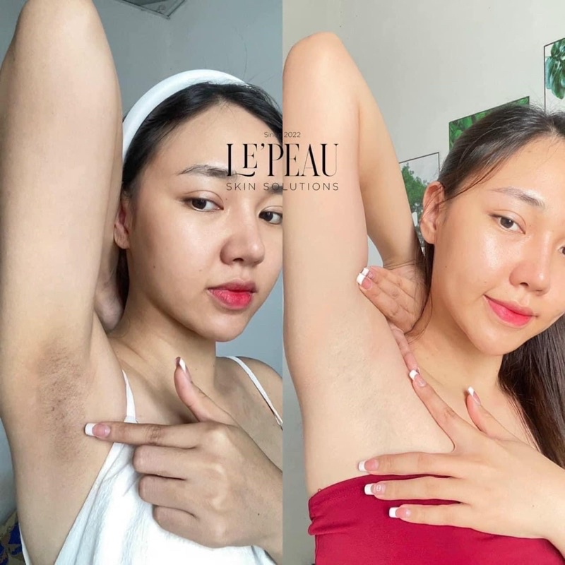 Peel nách retinol, peel body Le'peau trắng da mờ thâm sau 7 ngày tặng kem dưỡng ẩm - LEPEAU VIETNAM