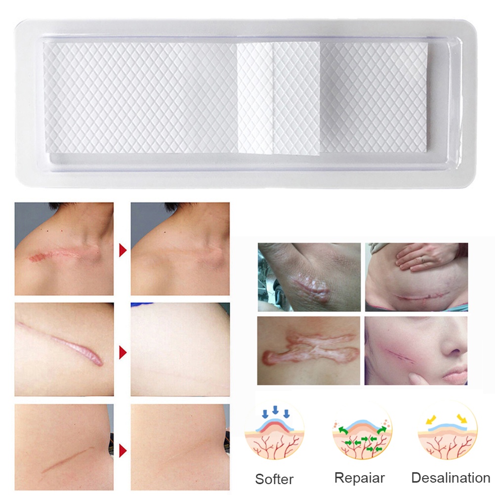 (Hàng Mới Về) Miếng Dán Silicone Trị Sẹo Tái Sử Dụng | BigBuy360 - bigbuy360.vn