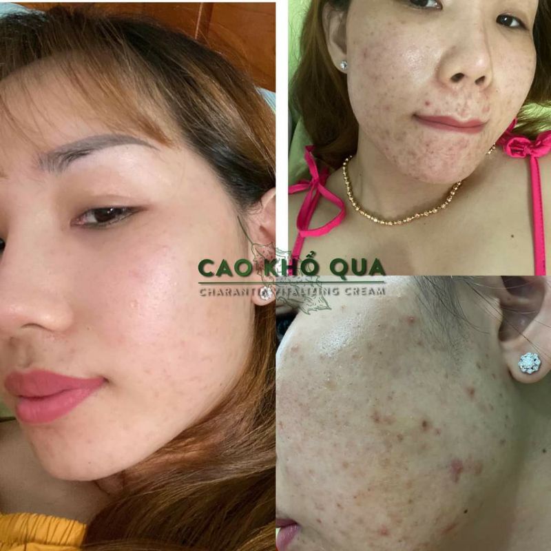 CAO KHỔ QUA-DIẾP CÁ-TRÀM TRÀ