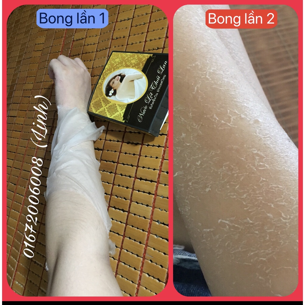 Tặng Kem Dưỡng | COMBO 2 Hộp Lột Da Collagen Công Nghệ Thái Lan | Thay da sinh học