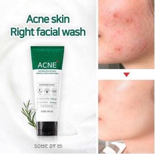 Sữa rửa mặt some by mi aha 30 day chuẩn auth