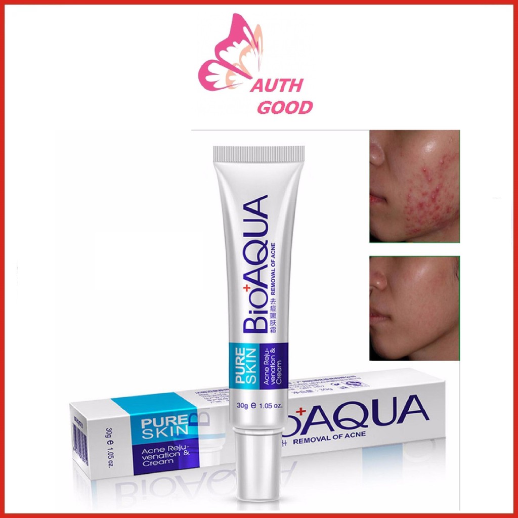 Kem mụn 💖FREESHIP💖 Kem giảm mụn Bioaqua Nội Địa Trung mờ sẹo giảm thâm