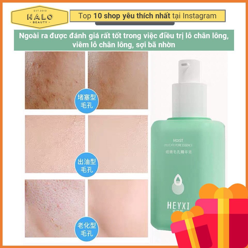 Serum Mụn Đầu Đen - Tinh Chất Heyxi Ngừa Mụn, Se Lỗ Chân Lông- Date Mới Nhất | BigBuy360 - bigbuy360.vn