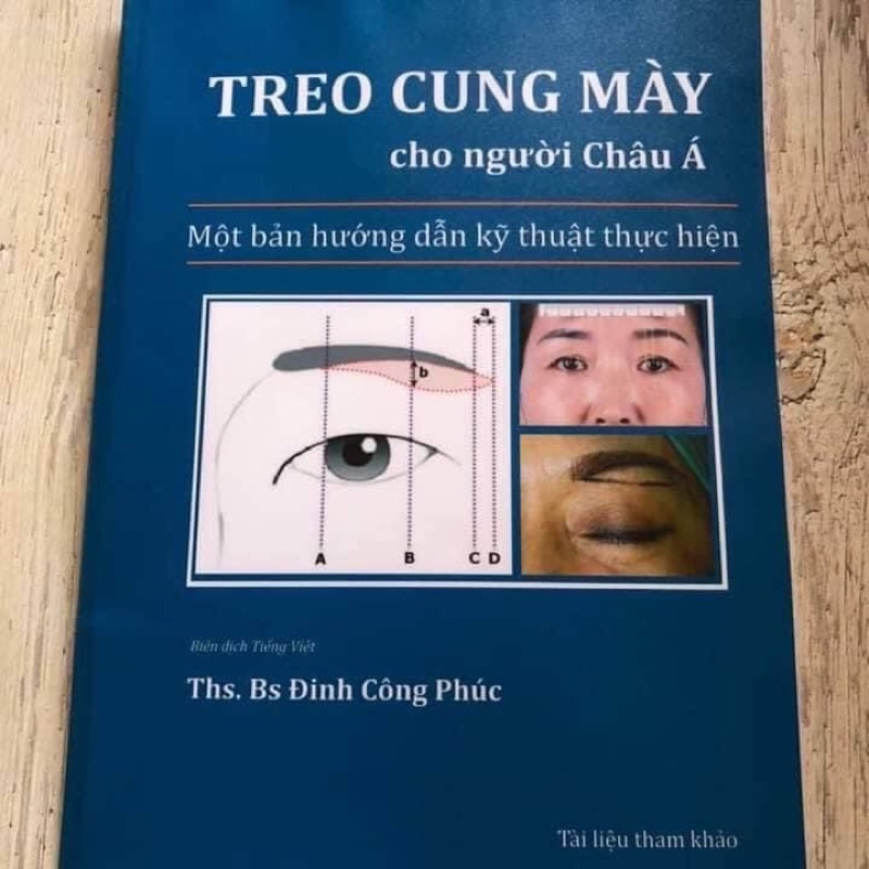 Tài Liệu Tham Khảo (Treo Cung Mày )