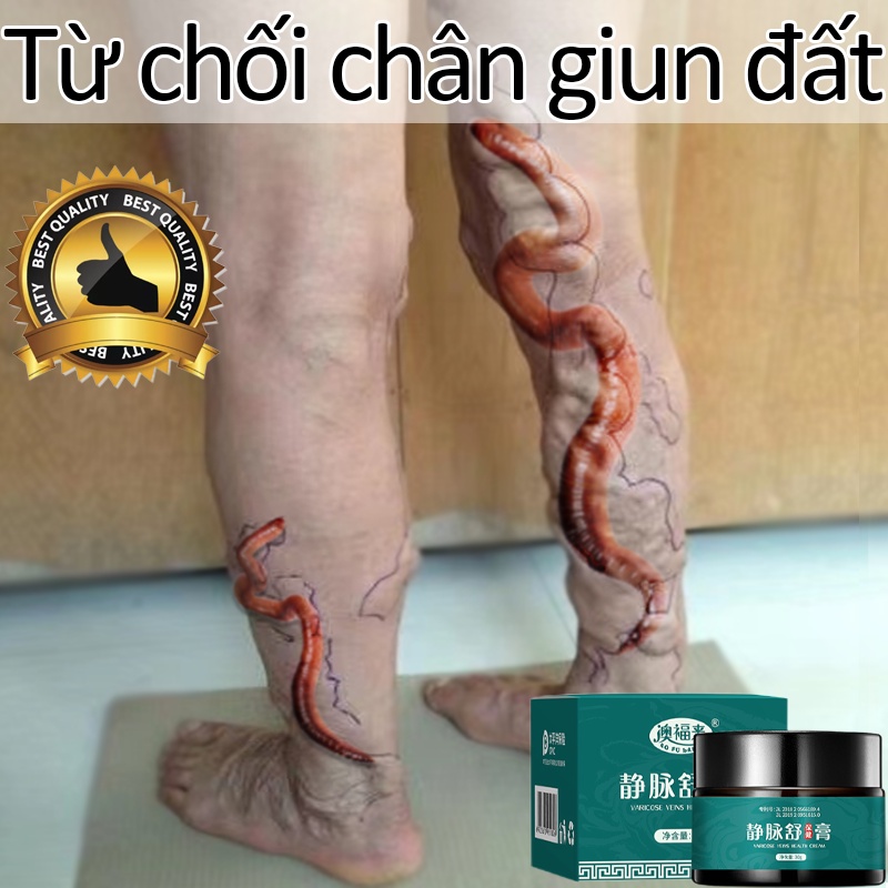 Thảo dược tự nhiên Kem giãn tĩnh mạch thúc đẩy tuần hoàn máu chống suy giãn tĩnh mạch do ngồi lâu giãn tĩnh mạch chân