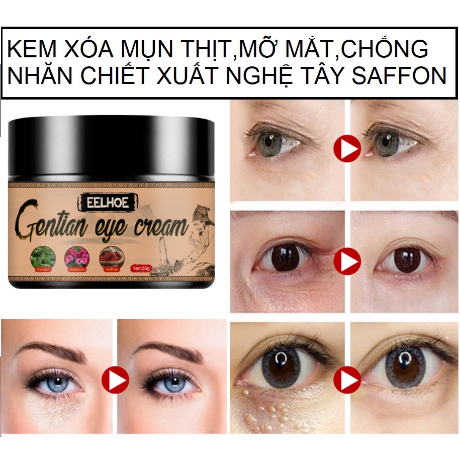 kem mụn thịt quanh mắt