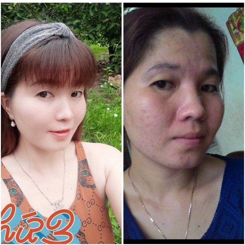 Bộ Kem Dưỡng Da Meiduzi Nhật Bản Chính Hãng Ban Đêm và Ban Ngày | BigBuy360 - bigbuy360.vn