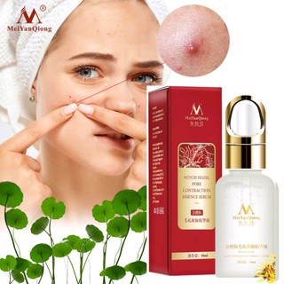 Serum Hết Mụn Se Khích Lỗ Chân Lông Trắng Da