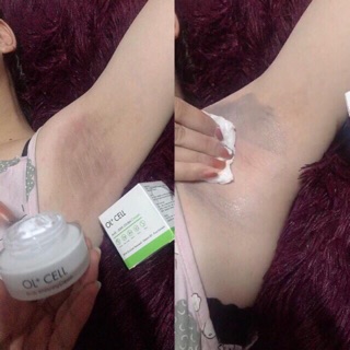 KEM HÚT THÂM NÁCH,NHŨ HOA,BẸN,MÔNG,ĐẦU GỐI...OL+CELL