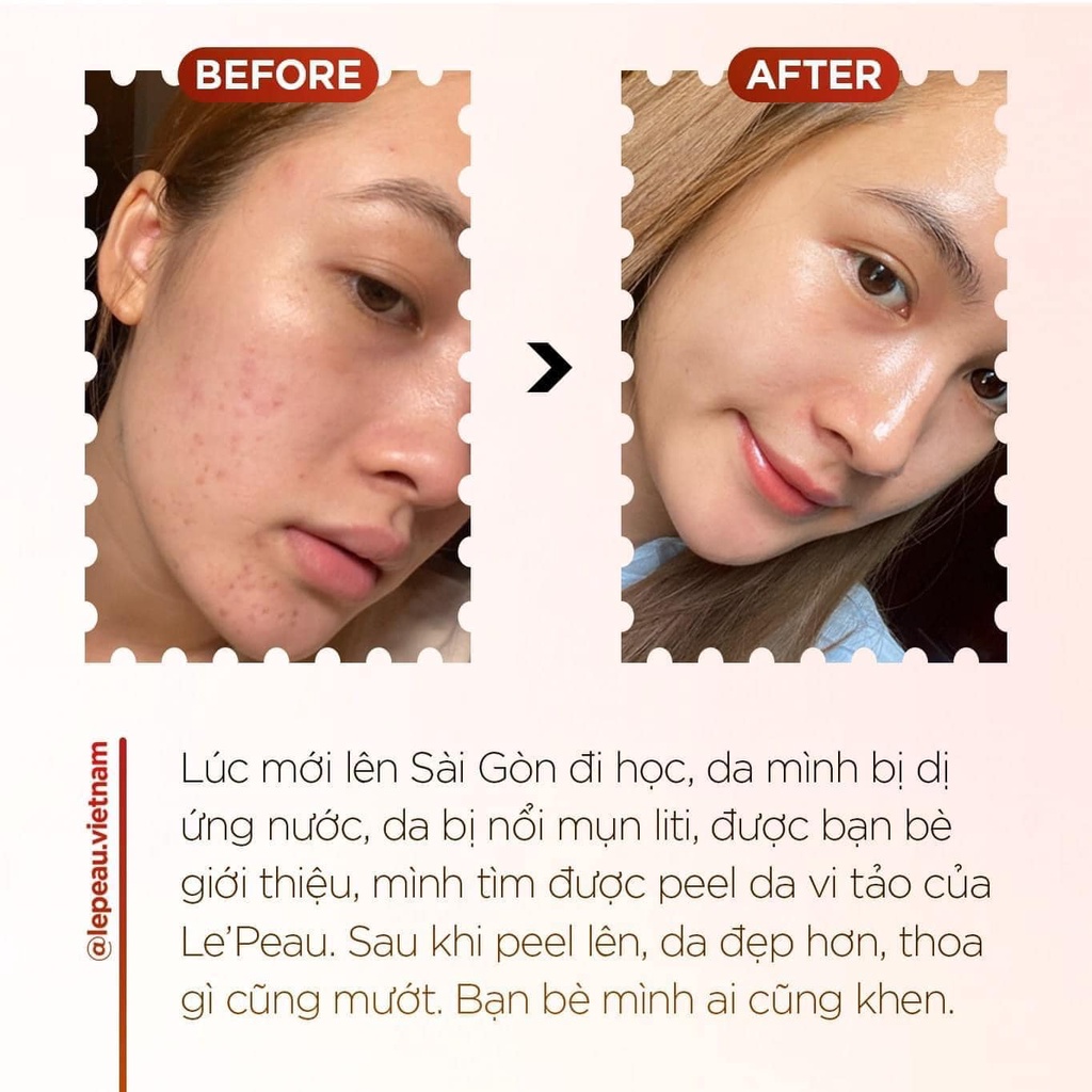 LE’PEAU - Peel da Vi Tảo Retinol chính hãng