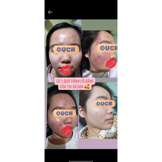 Serum thảo dược tái tạo NGỌC LINH SÂM