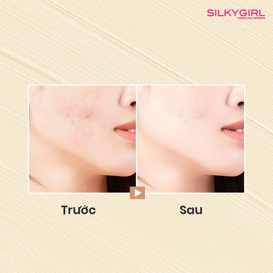 Kem Nền Dạng Lỏng Silkygirl Skin Perfect Liquid Foundation SPF30/PA+++ 25ml