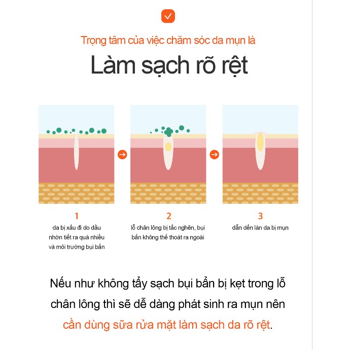 Sữa rửa mặt Aprilskin Carrot Acne Foam Cleanser 120ml