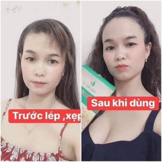 Set 5 kẹo mầm nở ngực lúa mạch gold