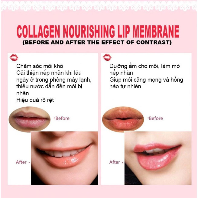 Combo 3 Mặt Nạ Dưỡng Môi Bioaqua Collagen Nourish Lips Membrane Mask 3x8g